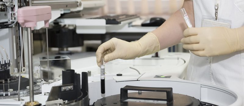 NATJEČAJ ZAKLADE KROHEM-a za istraživačke projekte mladih istraživača u području hematologije