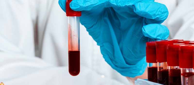 Istraživanje serološkog odgovora nakon cijepljenja protiv COVID19